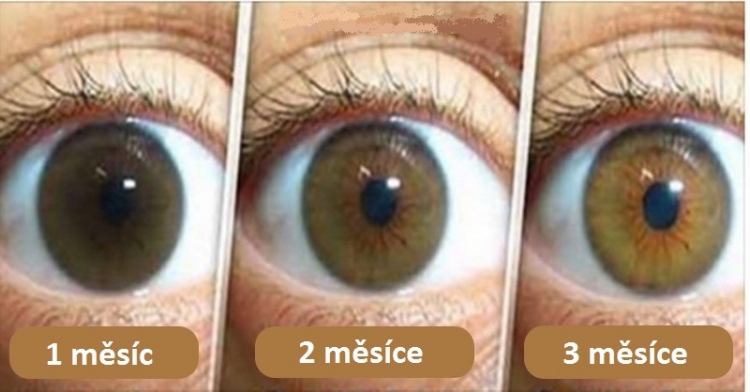 Tento přírodní lék vám vyčistí oči, zlepší vidění a zabrání vzniku zákalu