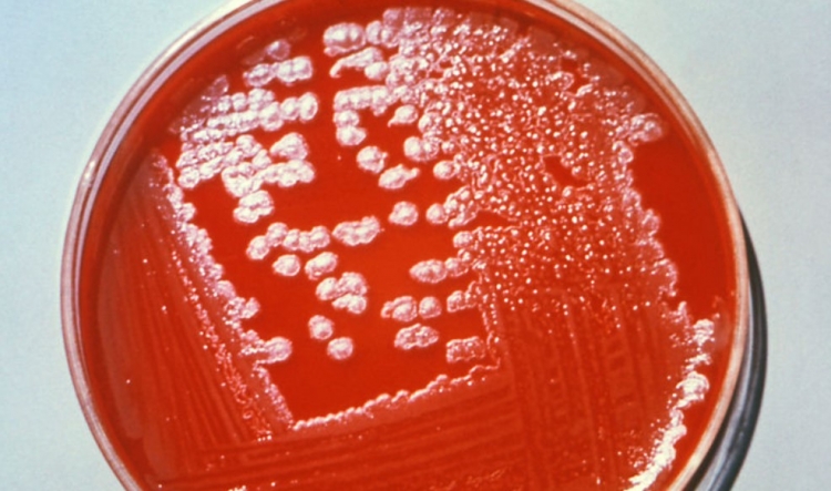 Spojené Státy zrušily zákaz experimentů se smrtelnými viry